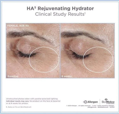 SkinMedica HA5 Rejuvenating Hydrator 2 oz – New Sealed